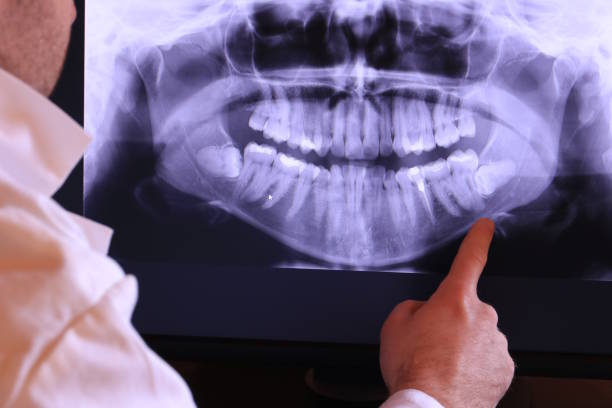 Best Emergency Care for Gum Disease in Wayne Heights, PA