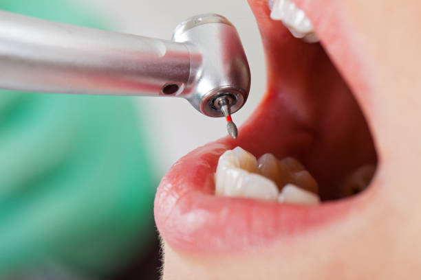 Best Broken or Chipped Tooth Repair in Wayne Heights, PA